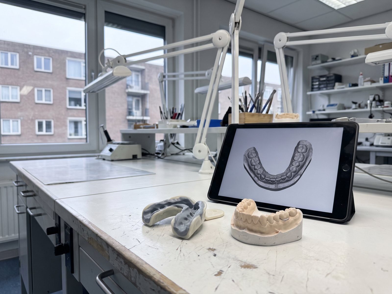 Abformlöffel mit Silikonabformung neben dem Meistermodell auf der Werkbank, daneben ein Tablet mit dem Intraoralscan derselben Situation.